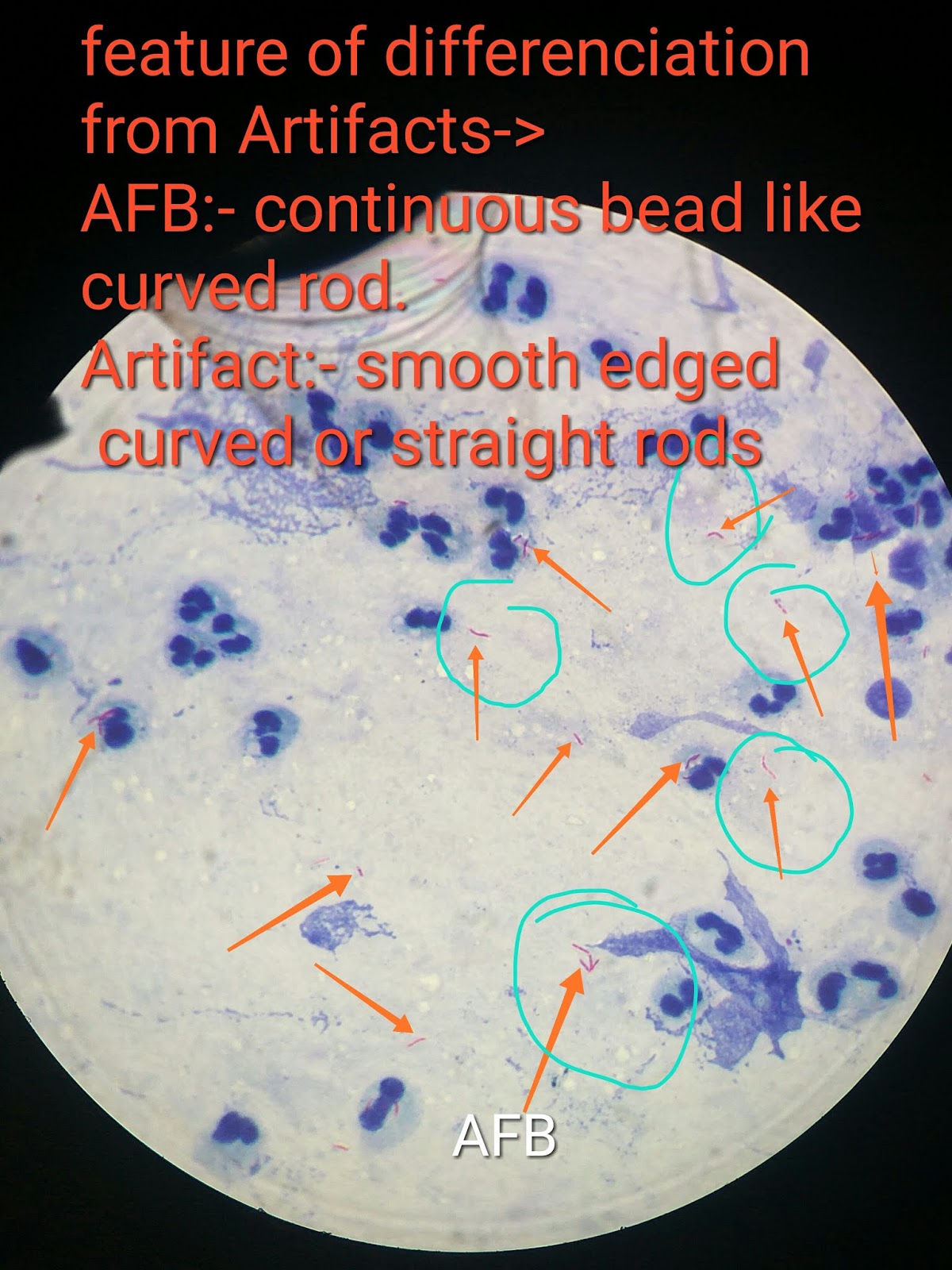 ZN staining method (AFB stain) part1