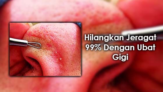 Cara Membuat Slime Dengan Ubat Gigi | hilangkan jeragat 99 dengan ubat gigi Cara Membuat Slime Dengan Ubat Gigi | hilangkan jeragat 99 dengan ubat gigi