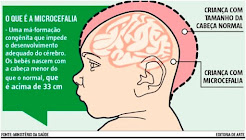 MICROCEFALIA