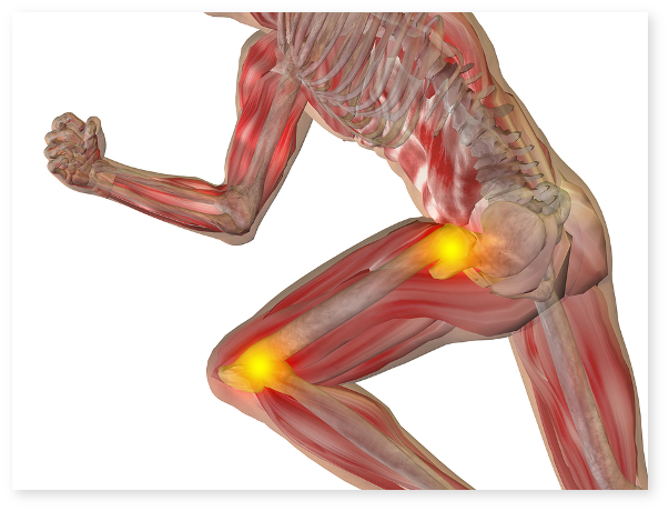 Dureri musculare în șold și picior în jos, factorii de, Durere de șold jos stânga