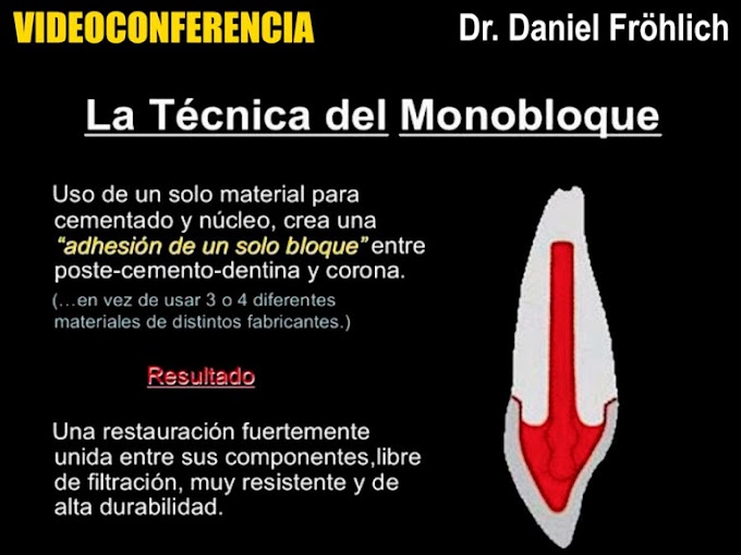 RECONSTRUCCIÓN POST-ENDODÓNTICA: El concepto del monobloque - Dr. Daniel Fröhlich