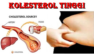 Cara menurunkan kolesterol tinggi secara tradisional