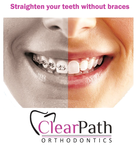 clearpath dental treatment without braces