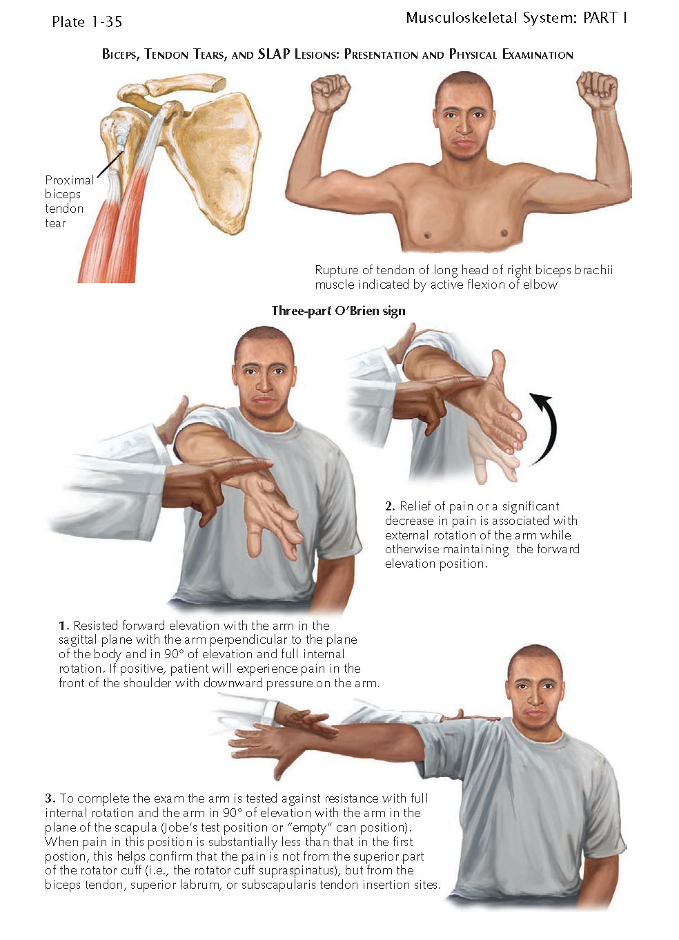 массаж шейно-грудного отдела. мануальная терапия триггерные точки. массаж реабилитация. классический массаж. точечный лечебный массаж.