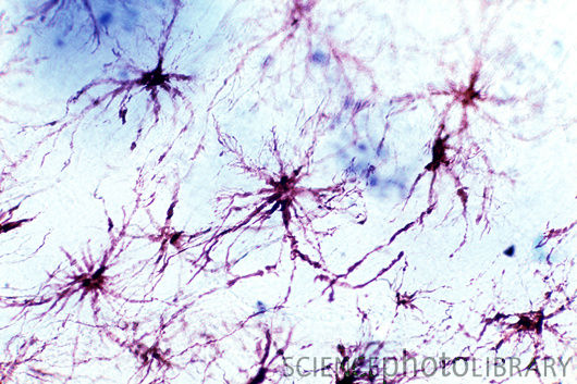 Teadvusehuvi: Neuronite võrdlus teiste rakkudega ja veidi taustbioloogiat