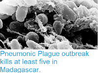 http://sciencythoughts.blogspot.co.uk/2017/09/pneumonic-plague-outbreak-kills-at.html