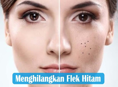 7 Cara Menghilangkan Flek Hitam Dengan Cepat dan Aman