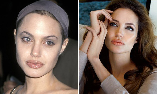 Angelina Jolie antes e depois da cirurgia no nariz