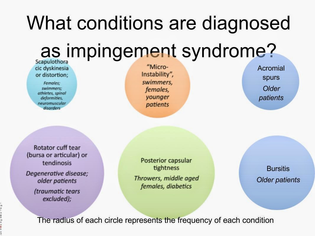 Shoulder and Elbow Surgery Shoulder Impingement/Rotator Cuff