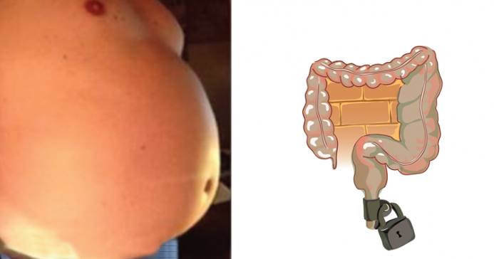 You're Not Fat! Your Stomach Is Swollen, Here's How You Get Rid Of It!