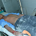 कानपुर - पनकी रतनपुर में करंट की चपेट में आने से युवक घायल