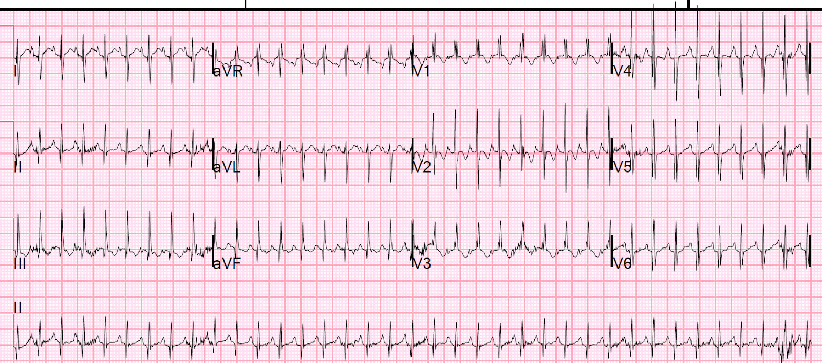 Dr Smith s ECG Blog dr-smith-s-ecg-blog