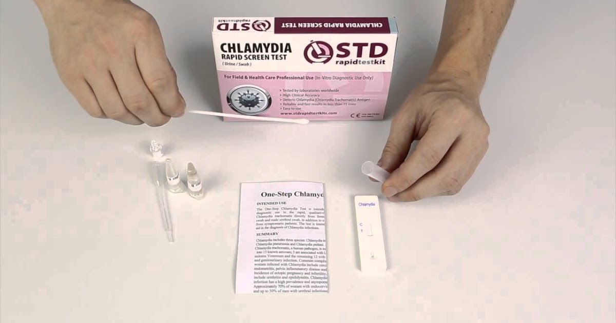 at home hiv std test at home hiv std test