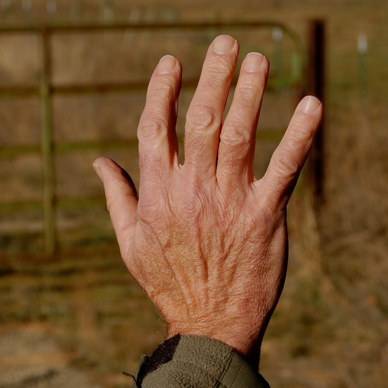 Blackoaknaturalist The Back Of My Hand