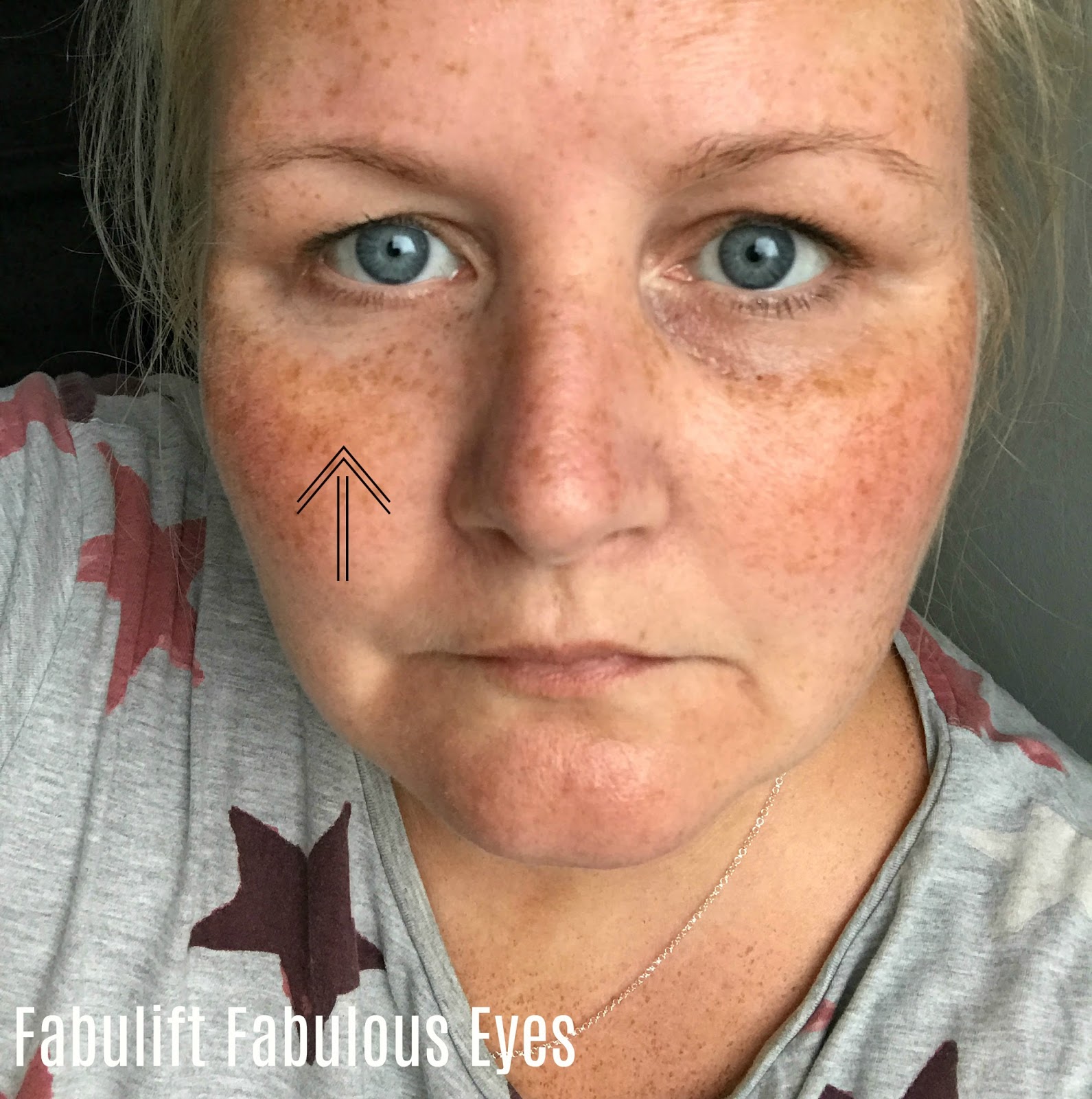Fabulift Fabulous Eyes Eye Lifting Serum Including Before And After