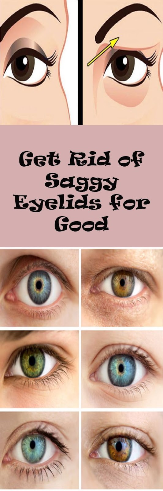what is good for sagging eyes