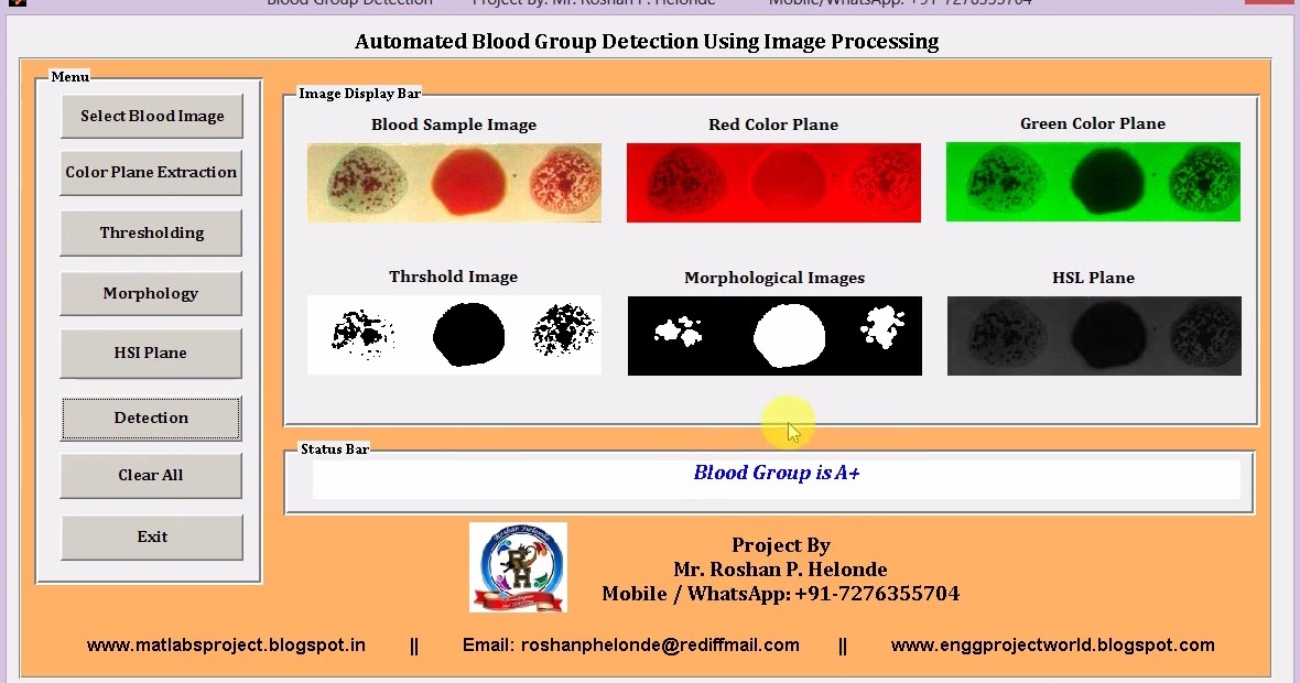 Blood Group Detection and Classification Using Image Processing Matlab