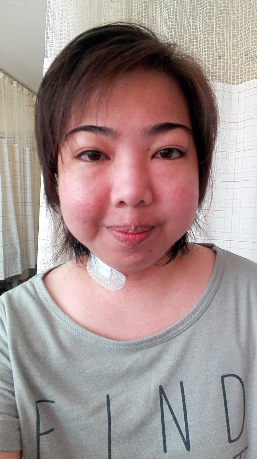 Fighting Lupus in Japan New roller coaster ride! July 14, 2018