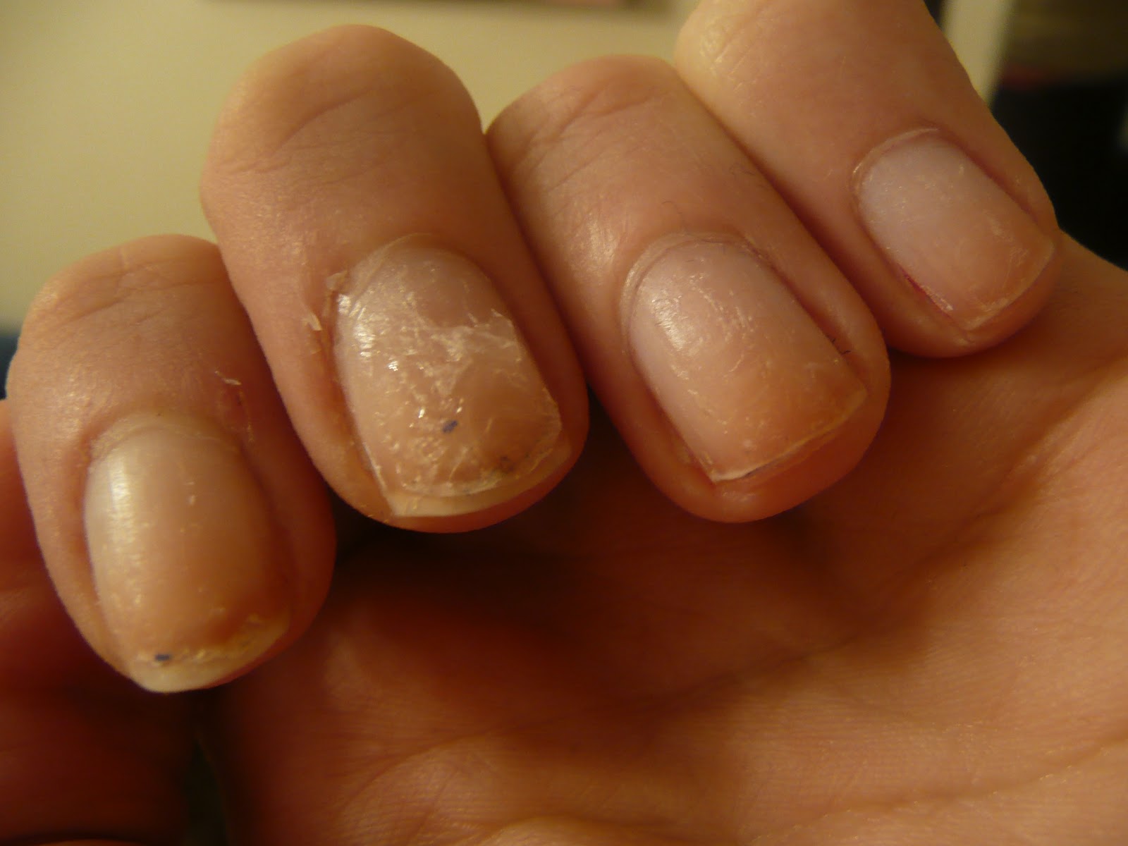How To Remove False Nail Glue Nail Ftempo