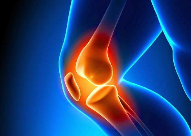 क्या आप घुटनों के असहनीय ददॅ से परेशान हैं। Get rid of knee pain क्या आप घुटनों के असहनीय ददॅ से परेशान हैं। Get rid of knee pain