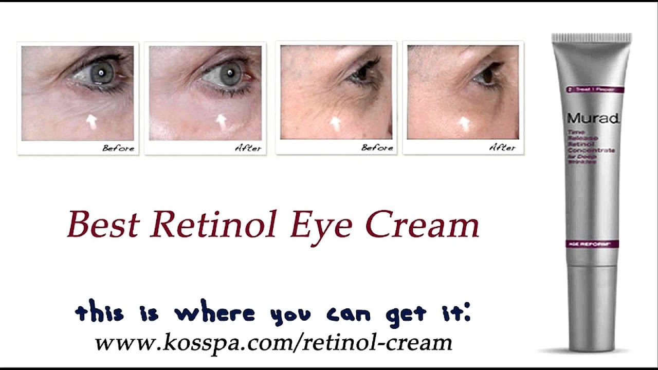 Retinol Retinol Effects Effect Choices