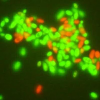 Yeast under Immuno fluorescence microscope
