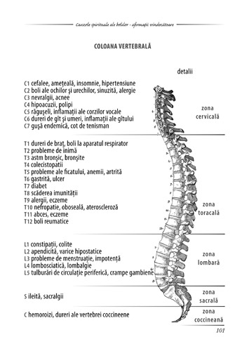 artrita coloana vertebrala leziuni la focuri de oase și articulații