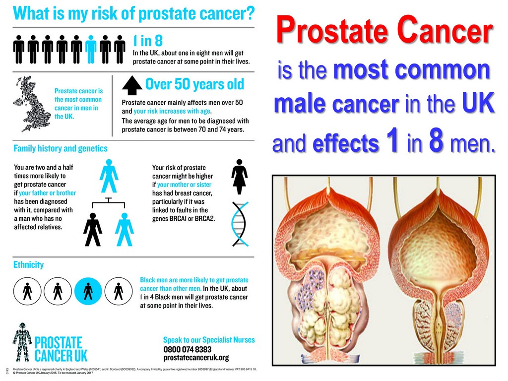 Masturbation And Prostate Cancer Pharma Reviews masturbation-and-prostate-cancer-pharma-reviews