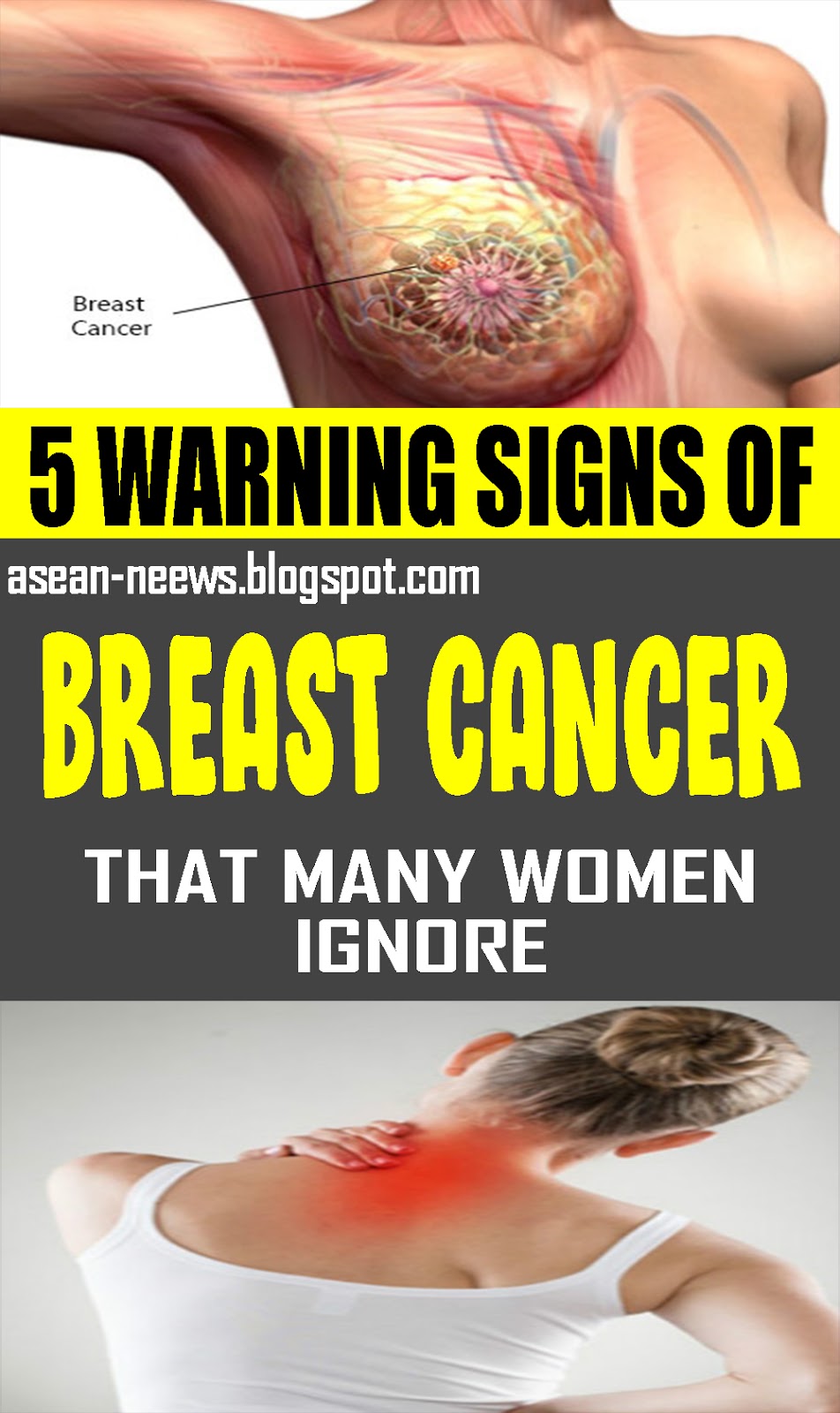 Warning Signs Of Breast Cancer That Many Women Ignore