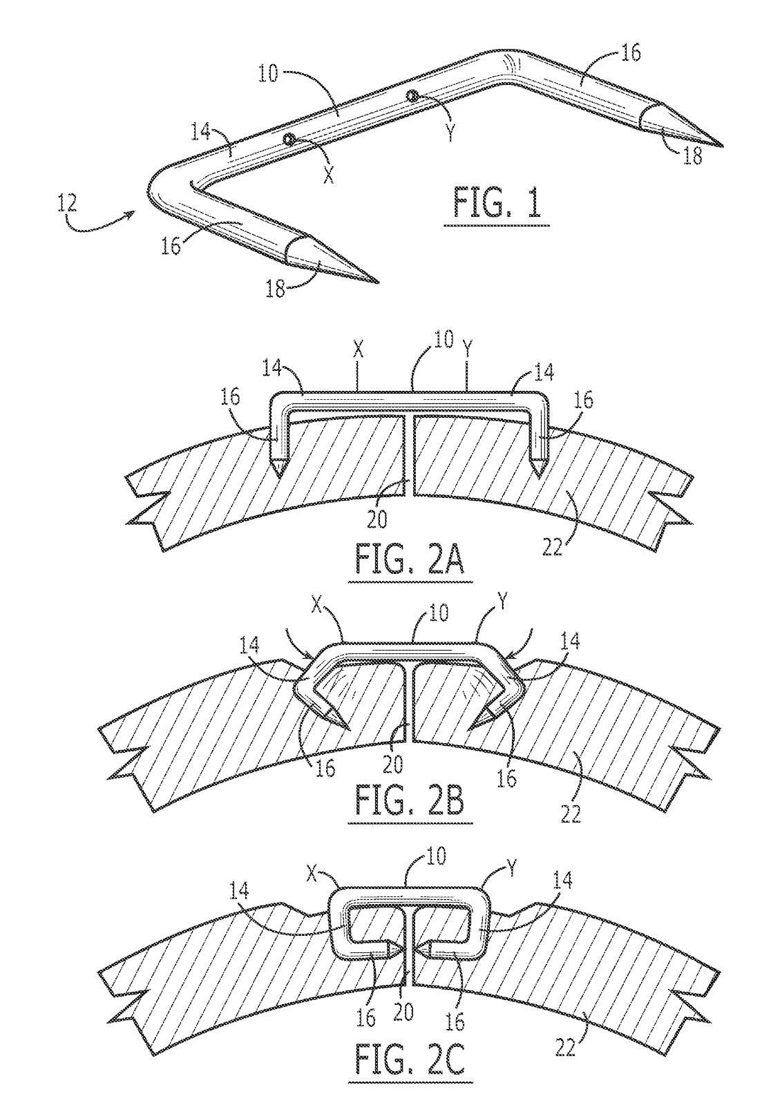 Pergelator Surgical Staples
