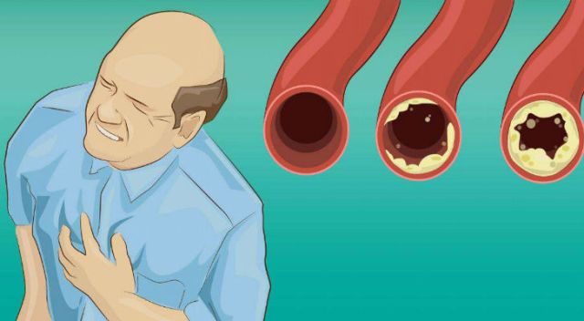 12 Foods You Must Eat To Unclog Your Arteries
