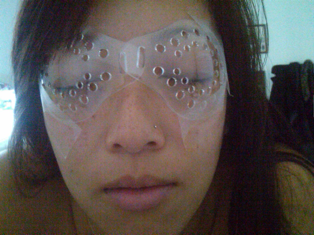 theSusyness My Lasik Experience