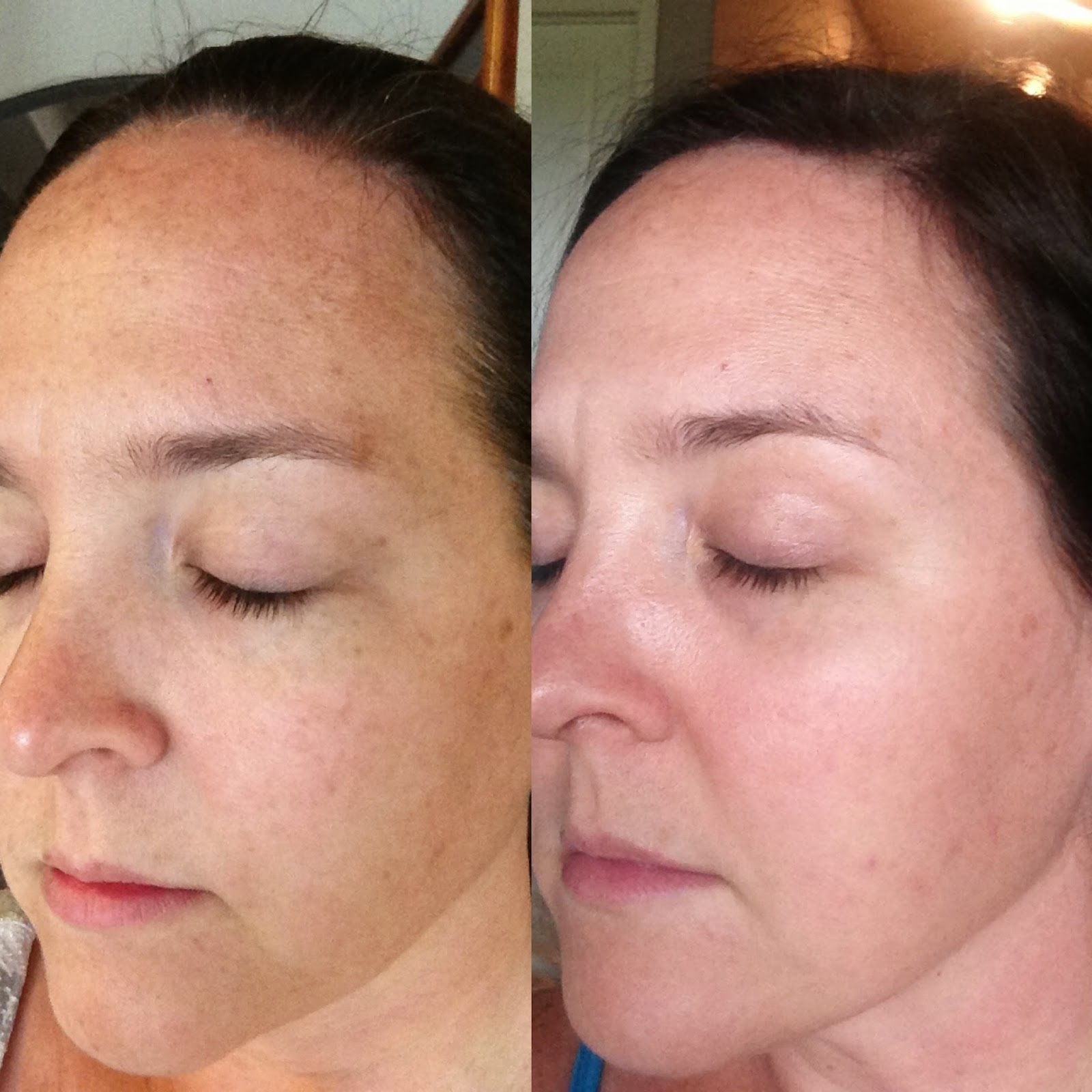 rodan and fields brightening reviews