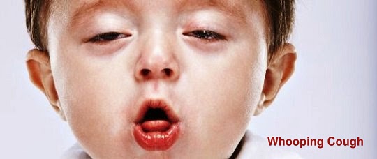 Whooping Cough Signs, Symptoms And Treatment