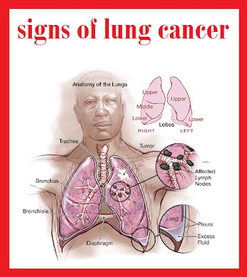 signs of lung cancer | symptoms lung cancer images