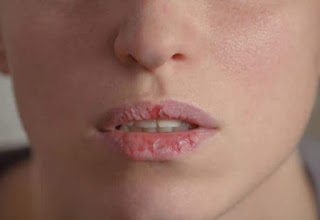 5 très bons soins pour adoucir et réparer vos lèvres très gercées