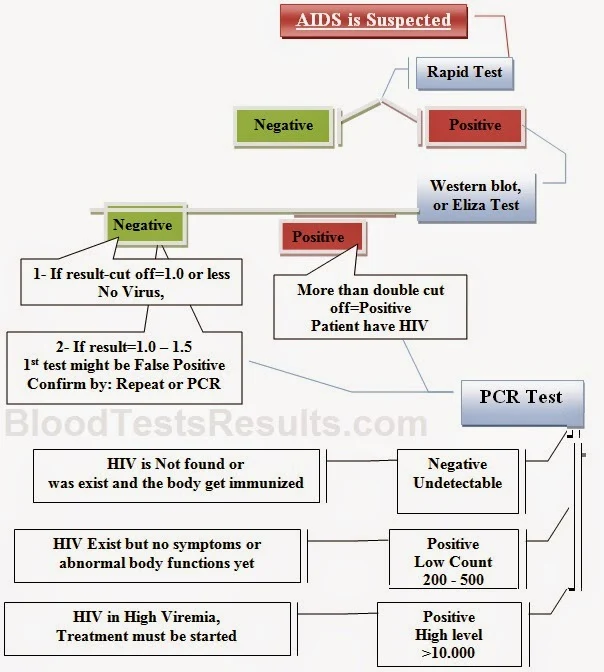 How to Use tests to diagnose HIV AIDS
