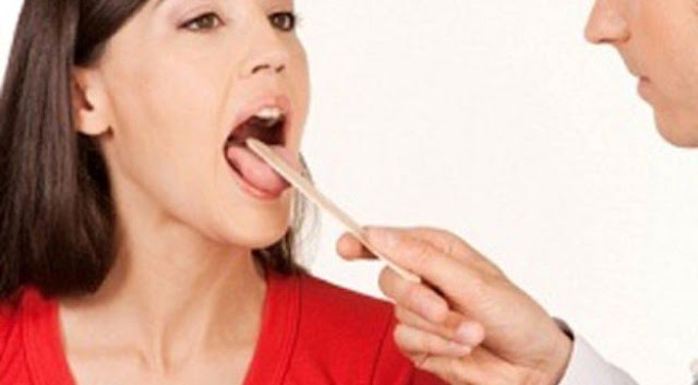 Sức khỏe, đời sống: Những lưu ý khi tẩy răng tại nhà bằng máng tẩy 4