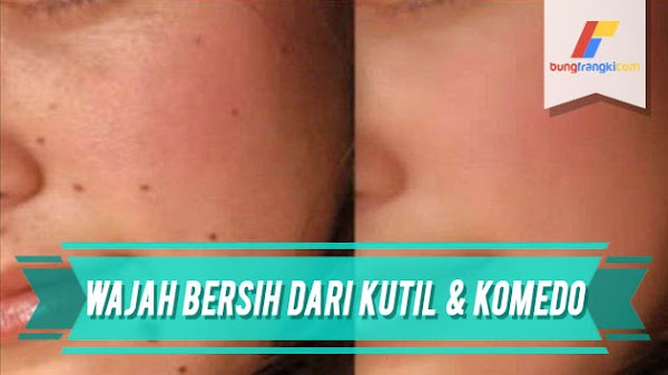 Cara Ampuh Menghilangkan Kutil, Komedo Jahat dan Bintik Hitam dari Wajah