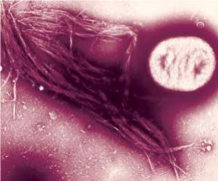 Enteroinvasive Escherichia coli (EIEC) Enteroinvasive Escherichia coli (EIEC)
