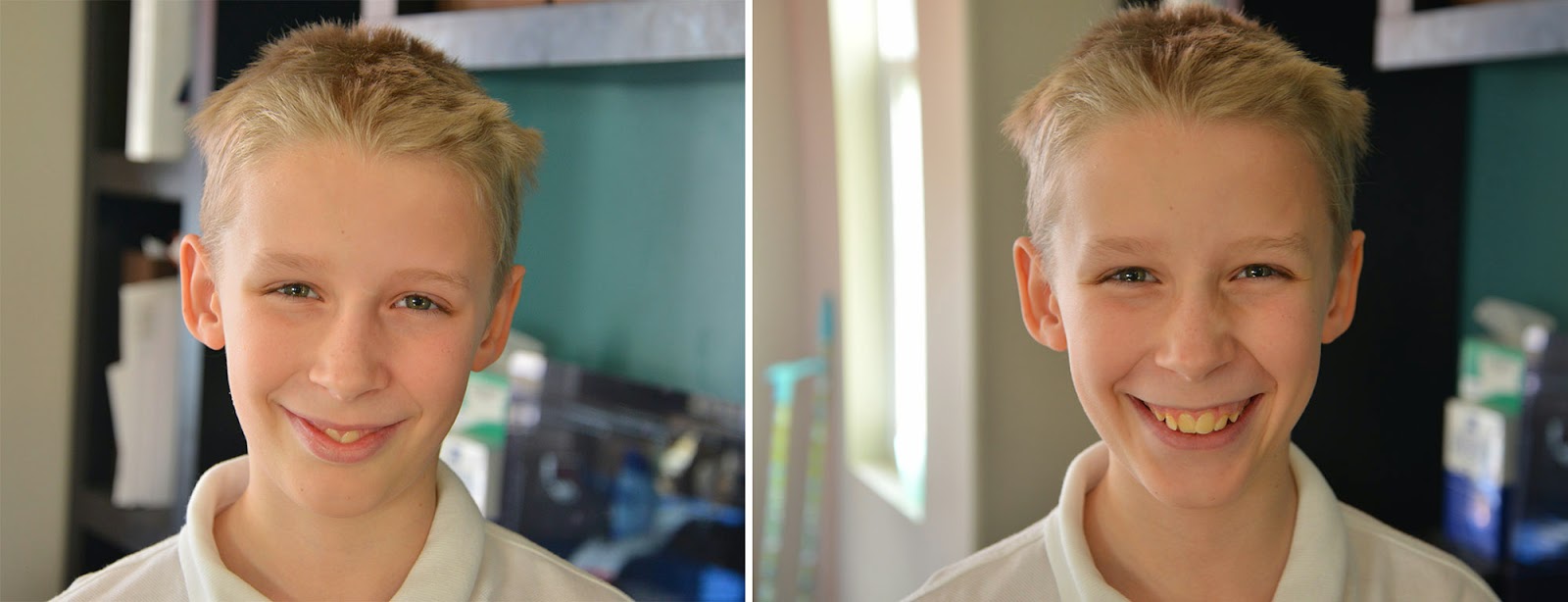 Fake Smile Vs Real Smile fake-smile-vs-real-smile