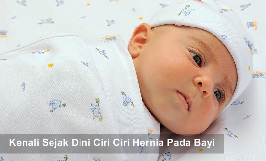 Ciri Ciri Hernia Pada Bayi Laki Laki | Obat Tradisional Hernia Pada Balita