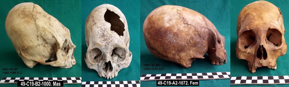 Bioarchaeology of Ancash