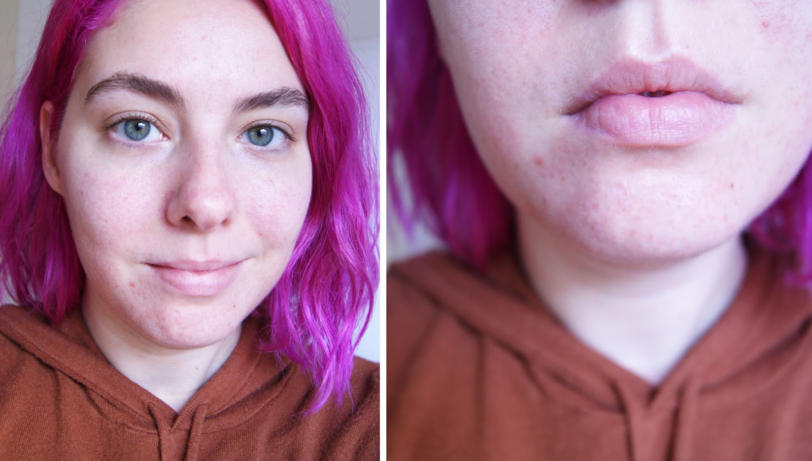 The Future of Skin Care Neutrogena Light Therapy Acne Mask Review