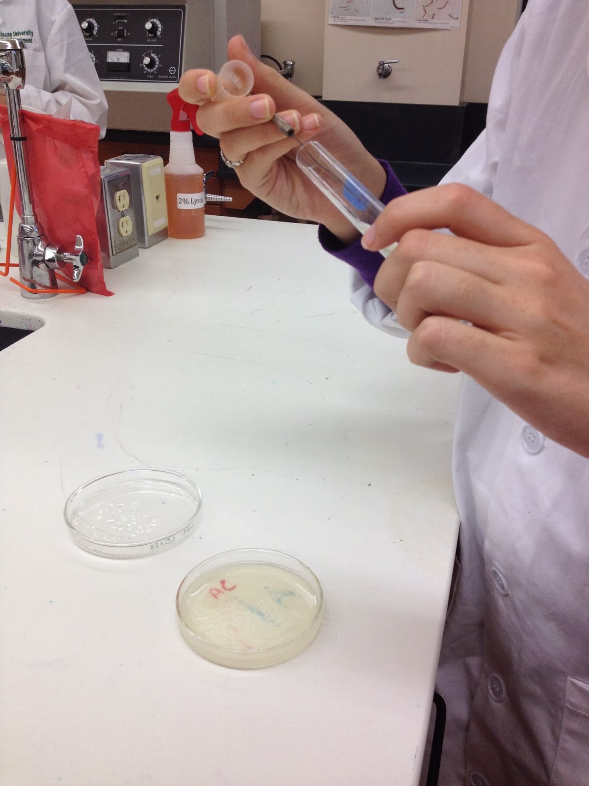 Rose & Lindsey's Medical Microbiology Blog Starch Hydrolysis Test