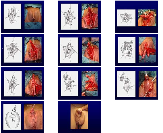 trans erkekce 04 03 16