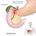  Adenomyomatosis Gallbladder ICD-10, Symptoms, Causes, Treatment