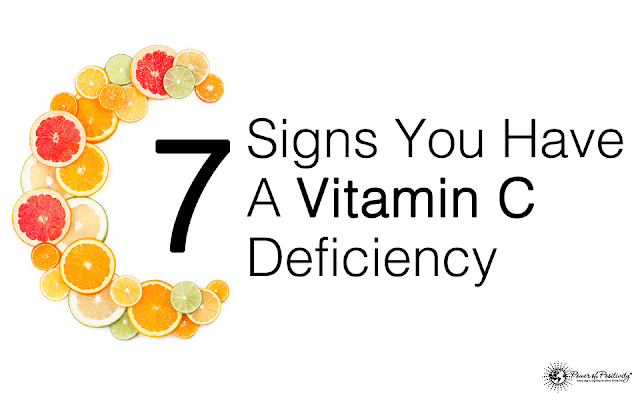 Here Are (9) Signs Your Body Lacks Vitamin C