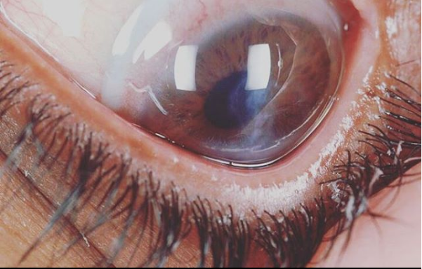 CONTACT LENSES Eyedolatry