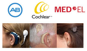 Cochlear Implant Comparison Chart 2018